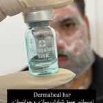 مرکز لیزر موهای زائد ماهور