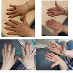 پاکسازی پوست صورت بانوان شرق تهران