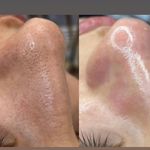 مژگان اسکین کرMojgan skincare