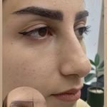 کلینیک زیبایی ورمیس