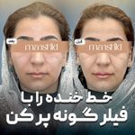 کلینیک زیبایی مانشید