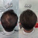 کلینیک پوست، مو، لیزر آنست