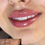 کلینیک زیبایی کاترین