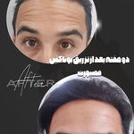 کلینیک لیزر و زیبایی لیلیا