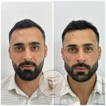 کلینیک پوست مو زیبایی  آیسان امیدی(وتنم)