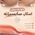 کلینیک پوست مو لیزر و زیبایی آریاناز