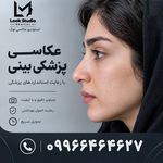 فتوگرافی پزشکی لوک