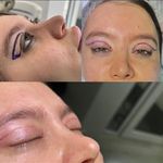 فیشال درمانی و پاکسازی پوست میرجلیلی