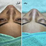 پاکسازی پوست و مو مهسام