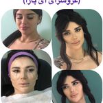 سالن زیبایی آی پارا(عروسرای آی پارا)