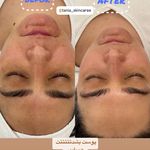 خدمات فیشیال و پاکسازی پوست