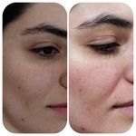 فیشیال / خدمات پوست / سالن زیبایی