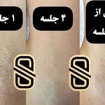 مطب لیزر و پوست و مو سابرینا شعبه نارمک