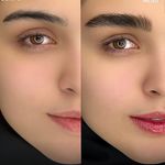 مرکز فیبروز و آرایش دائم عاطفه