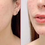 کلینیک لیزر الکس و زیبایی آنجل