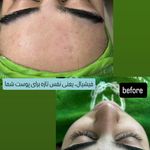 سالن زیبایی اکستنشن شرق - زیبایی طبیعی