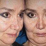 کلینیک زیبایی الماس کاملا اقساطی