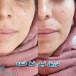 مرکز تخصصی لیزر و زیبایی سعادت آباد