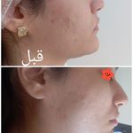 کلینیک تخصصی لاغری موضعی ولافیت