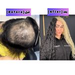 آکادمی تخصصی بافت مو و اکستنشن مو شینا