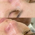 مرکز تخصصی فشیال صورت و اسکراب مو