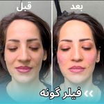 مرکز لیزر و زیبایی آرورا