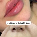 کلینیک لیزر و زیبایی مهسان