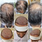کلینیک زیبایی پوست و مو آتریسا