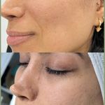خدمات فیشال و پاکسازی پوست در بندرعباس