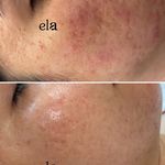 مرکز تخصصی پوست اِلا