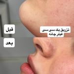کلینیک پوست مو لیزر ونوس
