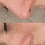 آموزش و خدمات پوست خواهران جعفرزاده