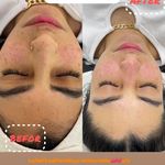 خدمات فیشیال و پاکسازی پوست