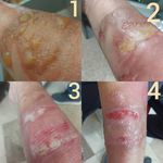 کلینیک زخم شکیبی