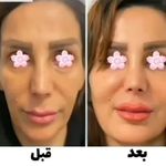 محصولات چاقی لاغری پوست مو