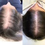 کلینیک پوست و مو و لیزر آتن