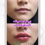 کلینیک پوست،مو،زیبایی و مرکز لیزر نوژا