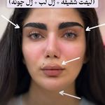 کلینیک لیزر و زیبایی دایان