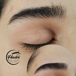 خدمات تخصصی ابرو حدیث معصومی