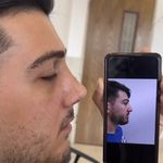 جراحی بینی دکتر اسدالله پور