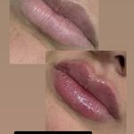 کلینیک زیبایی لاغری لیزر دانا