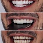 دندانپزشکی دکتر هومن باقری (بیمه نداریم)