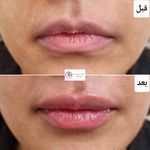 دکتر بهاره ملکی متخصص پوست ، مو و زیبایی