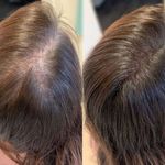 کلینیک پوست و مو و لیزر آتن