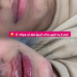 مرکز لیزر و کلینیک زیبایی پریفا