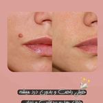 مطب زیبایی دکتر نلسا