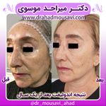 دکترمیراحدموسوی