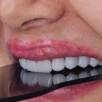مطب دندانپزشکی دکتر فاطمه محمودی افصح