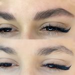 مرکز تخصصی فیبروز ابرو مژگان خناری
