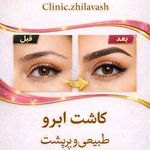 کلینیک پوست و زیبایی ژیلاوَش